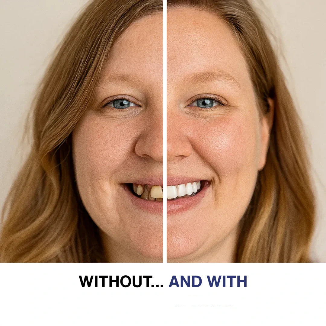 Zaho™ Clip-on Veneers