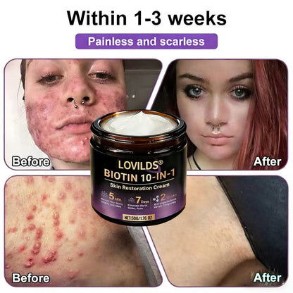 LOVILDS® Biotin 10-in-1 Skin Restoration Cream 🍀
