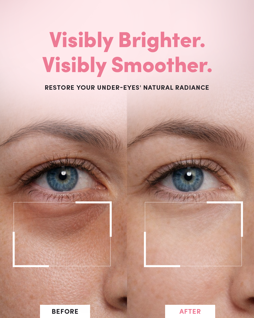 Peptide Collagen Hydrogel Eye Patches