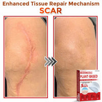 MicroNeedle Plant-based Skin Tag Removal Patch 🇺🇸