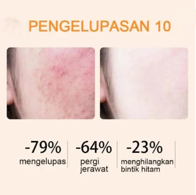 Oranje Enzym Peelinggel