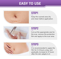✅Official Store |BBOJI® Hyaluronic Acid Nano Microneedle Repair Tape🏥(Treatment of old and new scars, reduction of surgical scars, stretch marks, keloids, acne, burns, warts, dermatomes and varicose veins)