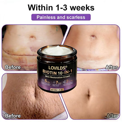LOVILDS® Biotin 10-in-1 Skin Restoration Cream 🍀