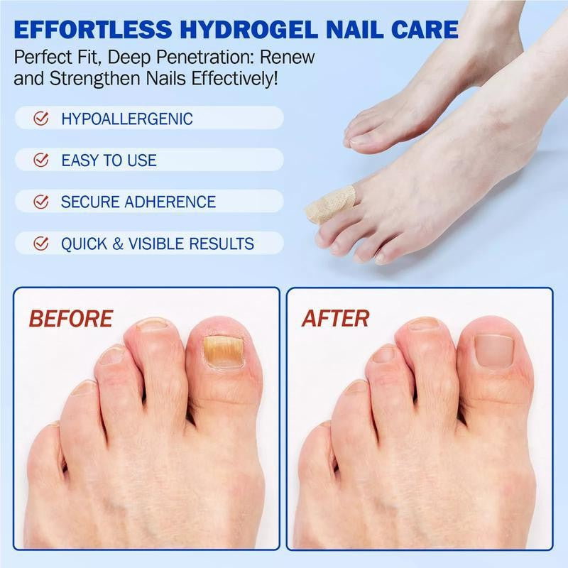Fungal Nails? This Patch Solves It with Ease! ✅21pcs/box