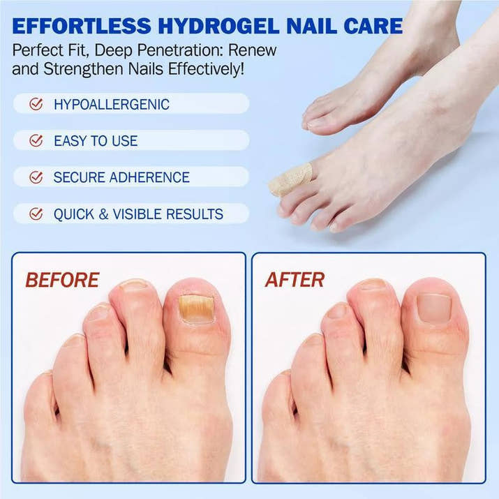 Fungal Nails? This Patch Solves It with Ease! ✅21pcs/box