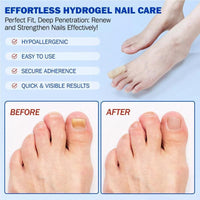Fungal Nails? This Patch Solves It with Ease! ✅21pcs/box