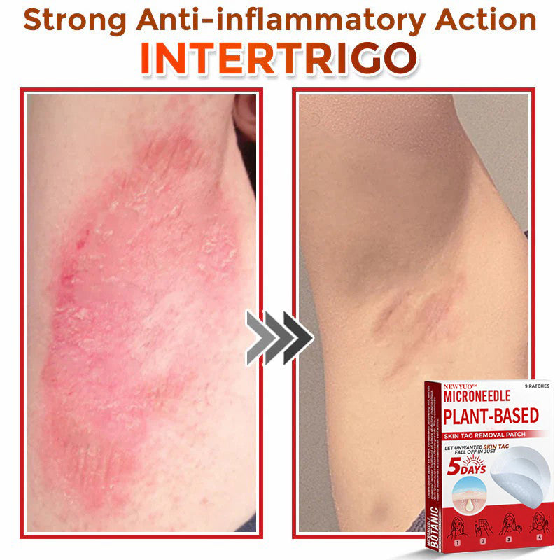 MicroNeedle Plant-based Skin Tag Removal Patch 🇺🇸