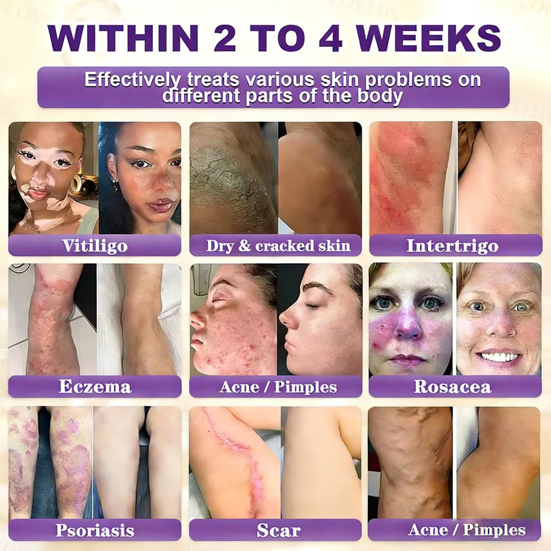 LOVILDS® Biotin 10-in-1 Skin Restoration Cream 🍀