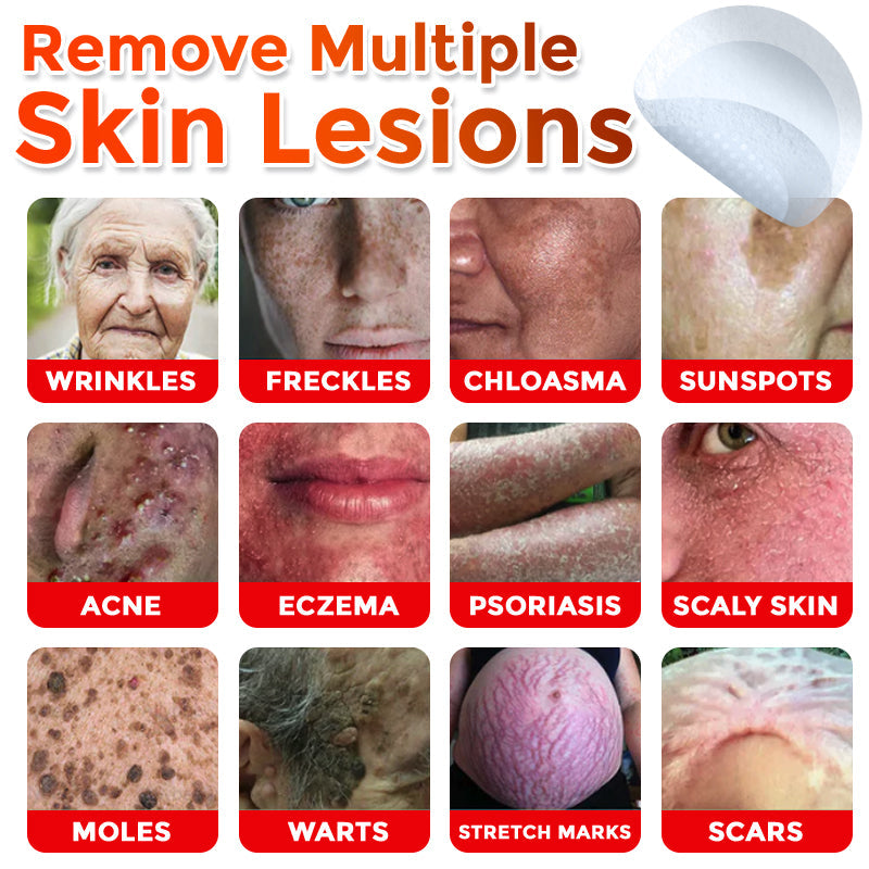 MicroNeedle Plant-based Skin Tag Removal Patch 🇺🇸