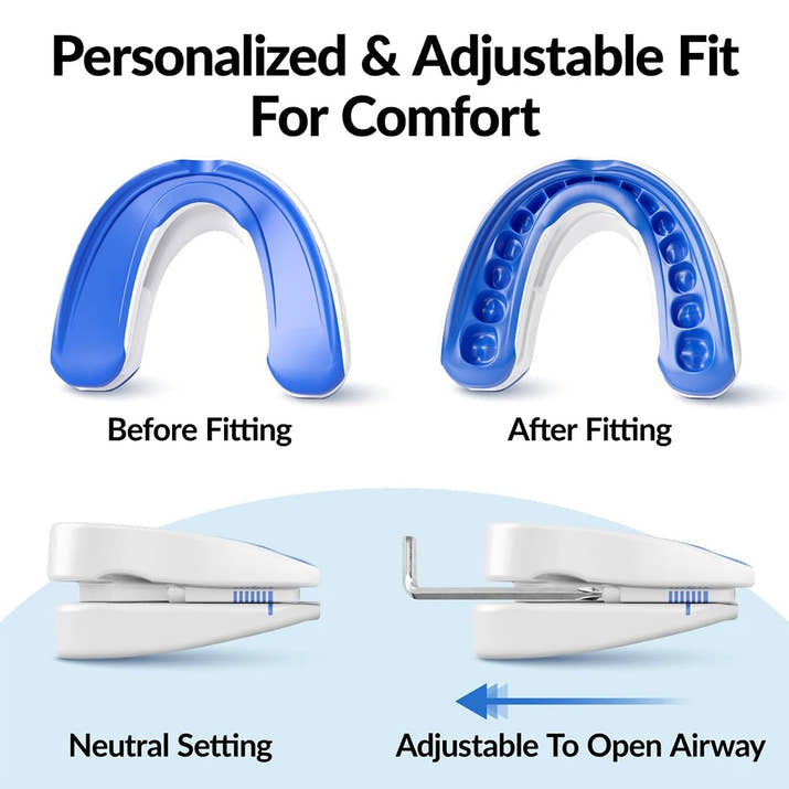 Anti-Snoring Mouthpiece