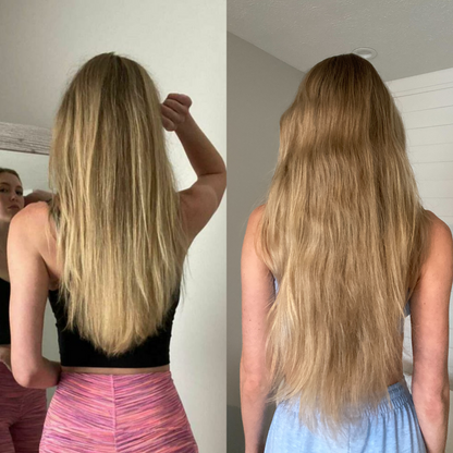 Gruaig Craiceann Ingne