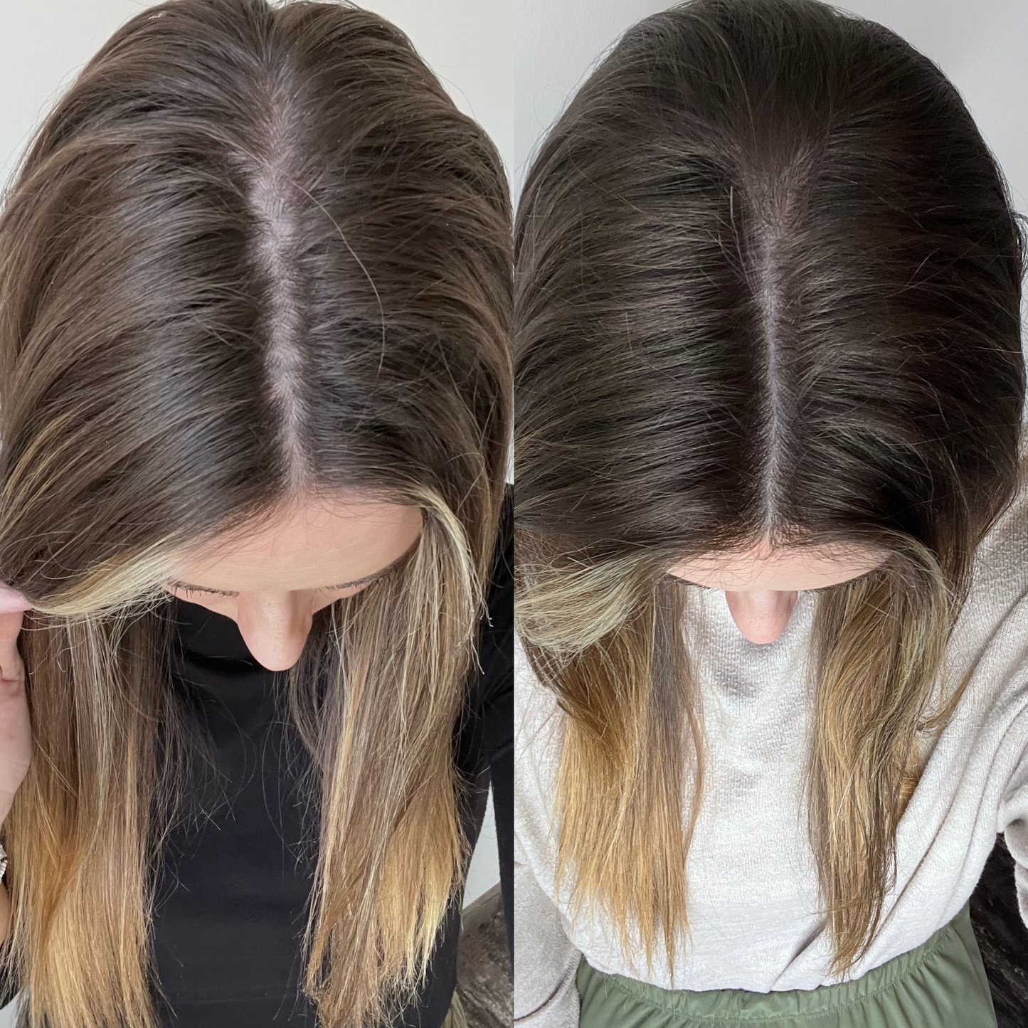 Gruaig Craiceann Ingne