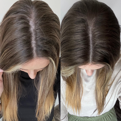 Gruaig Craiceann Ingne