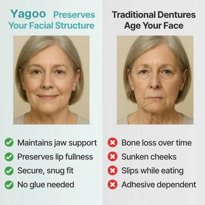 🦷Ends Today: 70% OFF! Yagoo® Custom-Fit Full Functional DenturesMake you more confident