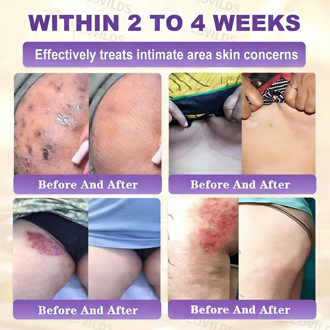 LOVILDS® Biotin 10-in-1 Skin Restoration Cream 🍀