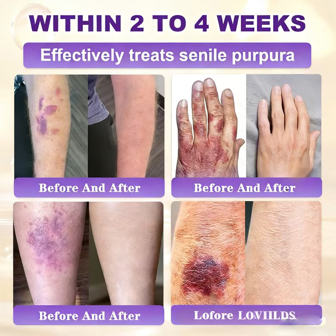 LOVILDS® Biotin 10-in-1 Skin Restoration Cream 🍀