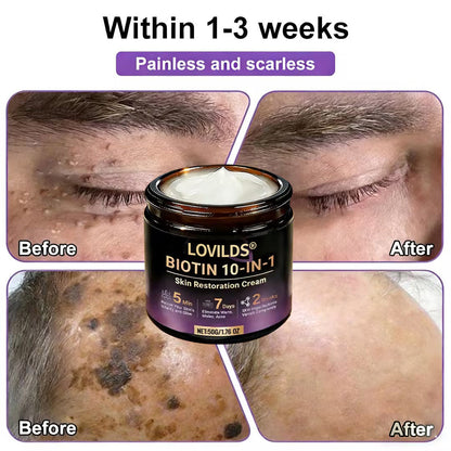 LOVILDS® Biotin 10-in-1 Skin Restoration Cream 🍀