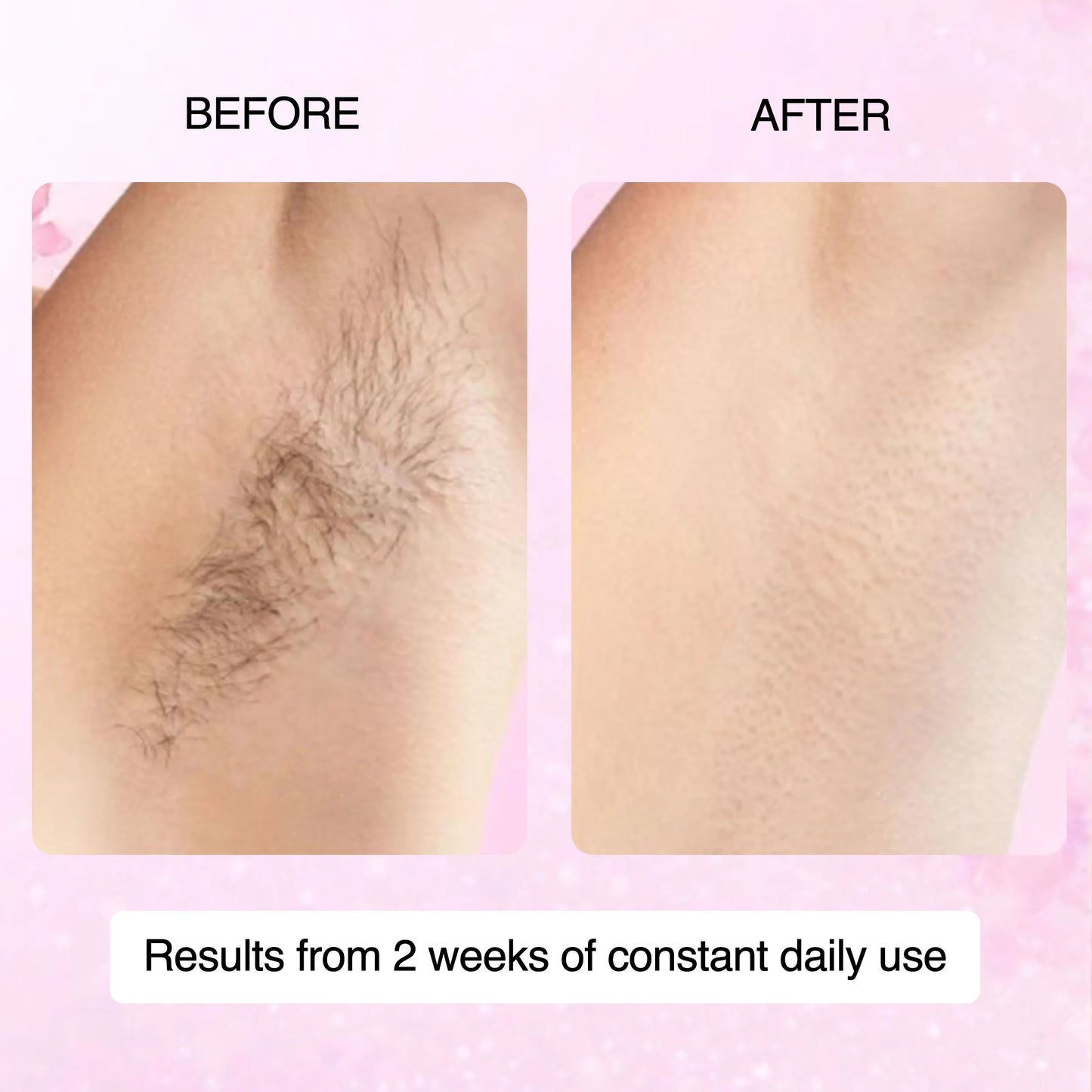 Cyperus Rotundus Skin Serum