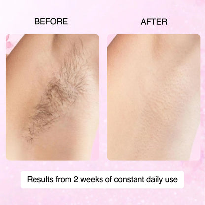 Cyperus Rotundus Skin Serum