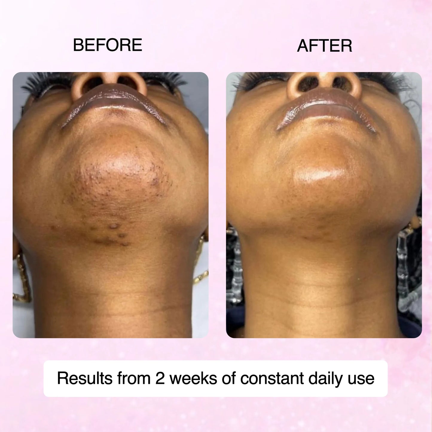 Cyperus Rotundus Skin Serum