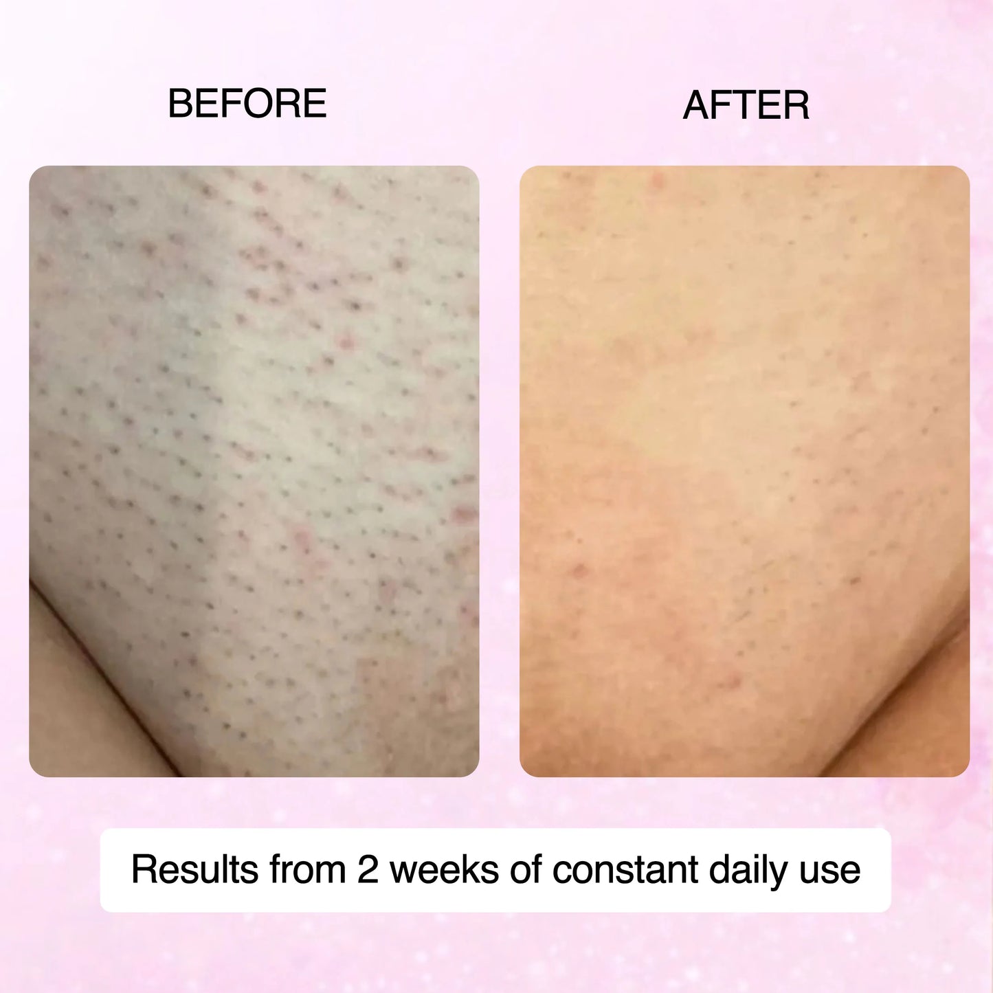 Cyperus Rotundus Skin Serum