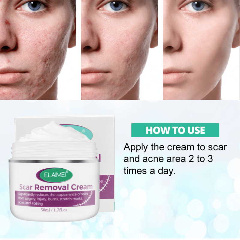 Skin Rebound Cream